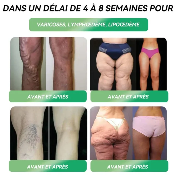 🛍️ Boutique Officielle | 𝑆𝑇𝐷𝐸𝐼®✅ Solution Orale 𝐺𝐿𝑃-1 pour la 𝑝𝑒𝑟𝑑𝑒 𝑑𝑒 𝑝𝑜𝑖𝑑𝑠 – 👨‍⚕️ Pour lutter contre l’𝑜𝑏𝑒́𝑠𝑖𝑡𝑒́, les maladies 𝑐𝑎𝑟𝑑𝑖𝑜𝑣𝑎𝑠𝑐𝑢𝑙𝑎𝑖𝑟𝑒𝑠, le 𝑑𝑖𝑎𝑏𝑒̀𝑡𝑒, l’𝑎𝑝𝑛𝑒́𝑒 𝑑𝑢 𝑠𝑜𝑚𝑚𝑒𝑖𝑙, les 𝑝𝑟𝑜𝑏𝑙𝑒̀𝑚𝑒𝑠 𝑎𝑢𝑥 𝑎𝑟𝑡𝑖𝑐𝑢𝑙𝑎𝑡𝑖𝑜𝑛𝑠 et bien plus encore🍀