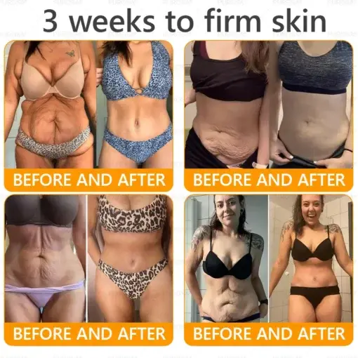 PUROSA® Bee Venom Wrinkle-Firming Multi-purpose Cream