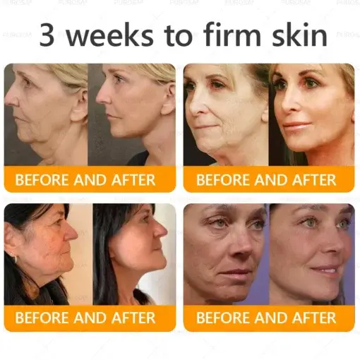 PUROSA® Bee Venom Wrinkle-Firming Multi-purpose Cream