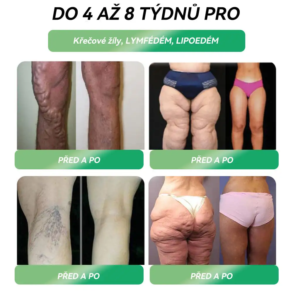 🌿 Oficiální obchod ČR | STDEI® GLP-1 8-v-1 Fit & Vital Řešení (Jednou denně, viditelné změny za 7 dní) ✅ Obezita, kardiovaskulární zdraví, cukrovka, spánková apnoe, zdraví střev, problémy se klouby a další.