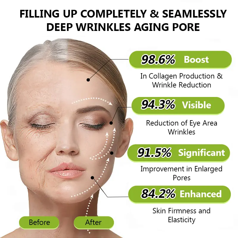 Official Store | Rejuvenate Your Skin Instantly ๐ซ STDEIยฎ BOTOX & VITA A RETINOL SHOT Anti-Wrinkle Lifting & Firming Cream