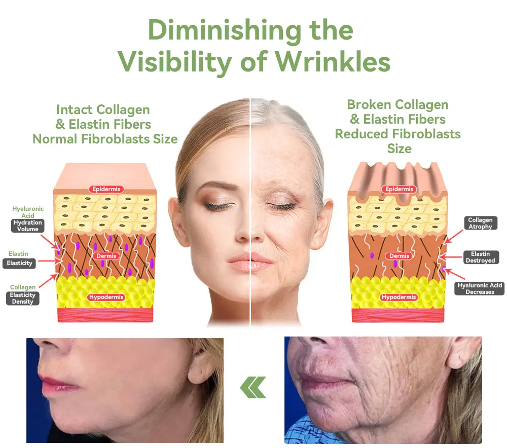 (Official Store) STDEI® 🎉 Natural Collagen Firming Cream - Year-End Sale 70% Off