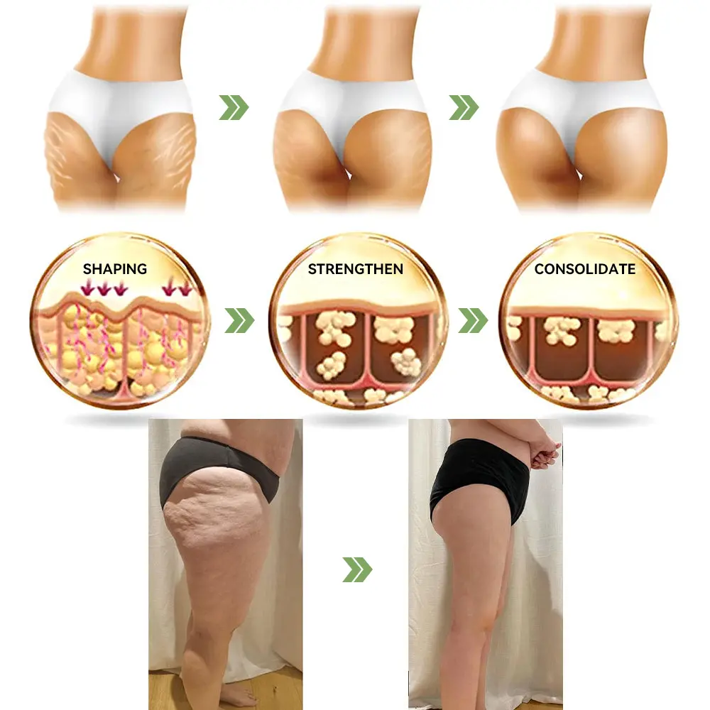 (Official Store) STDEI® 🎉 Natural Collagen Firming Cream - Year-End Sale 70% Off