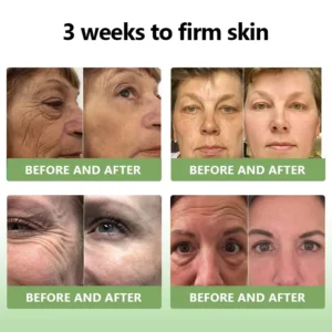 (Official Store) STDEI® 🎉 Natural Collagen Firming Cream - Year-End Sale 70% Off