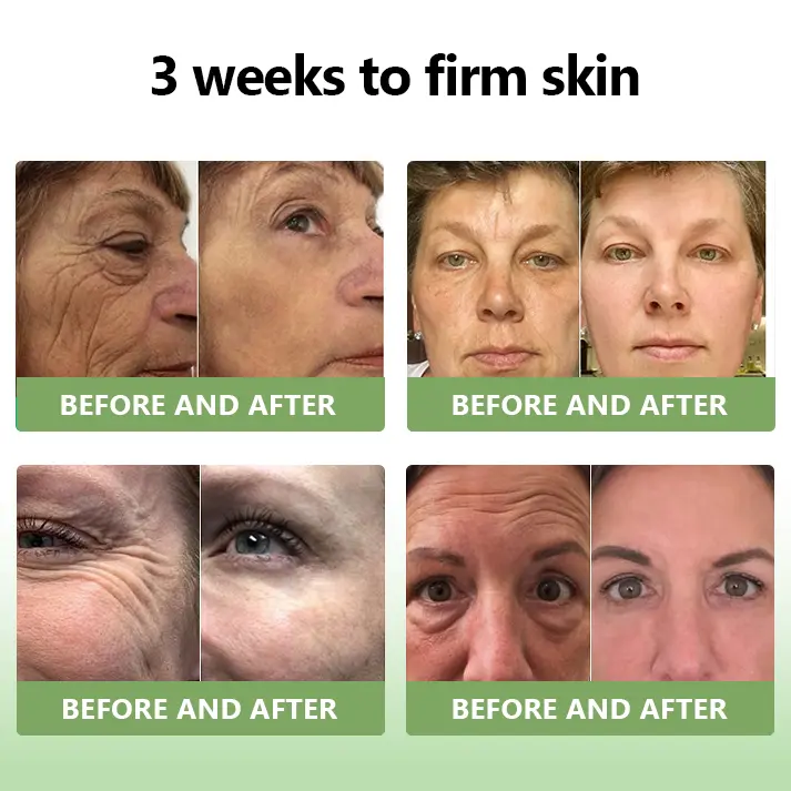 (Official Store) STDEI® 🎉 Natural Collagen Firming Cream - Year-End Sale 70% Off