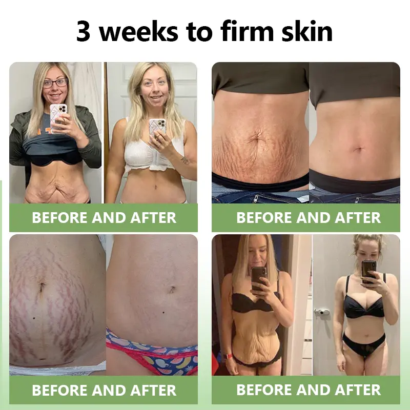 (Official Store) STDEI® 🎉 Natural Collagen Firming Cream - Year-End Sale 70% Off