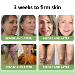 (Official Store) STDEI® 🎉 Natural Collagen Firming Cream - Year-End Sale 70% Off