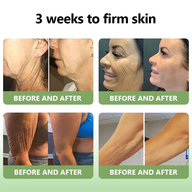 (Official Store) STDEI® 🎉 Natural Collagen Firming Cream - Year-End Sale 70% Off