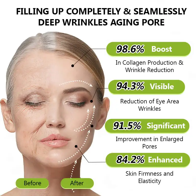 uk ๐ถ๐๐๐๐๐๐๐ ๐บ๐๐๐๐๐ฉโโ๏ธ๐| Regain youthful skin nown ๐ซSTDEIยฎ BOTOX & VITA A RETINOL SHOT Wrinkle Lift Tightening Cream