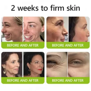 uk ๐ถ๐๐๐๐๐๐๐ ๐บ๐๐๐๐๐ฉโโ๏ธ๐| Regain youthful skin nown ๐ซSTDEIยฎ BOTOX & VITA A RETINOL SHOT Wrinkle Lift Tightening Cream