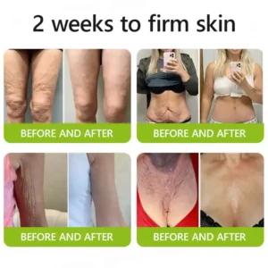 uk ๐ถ๐๐๐๐๐๐๐ ๐บ๐๐๐๐๐ฉโโ๏ธ๐| Regain youthful skin nown ๐ซSTDEIยฎ BOTOX & VITA A RETINOL SHOT Wrinkle Lift Tightening Cream