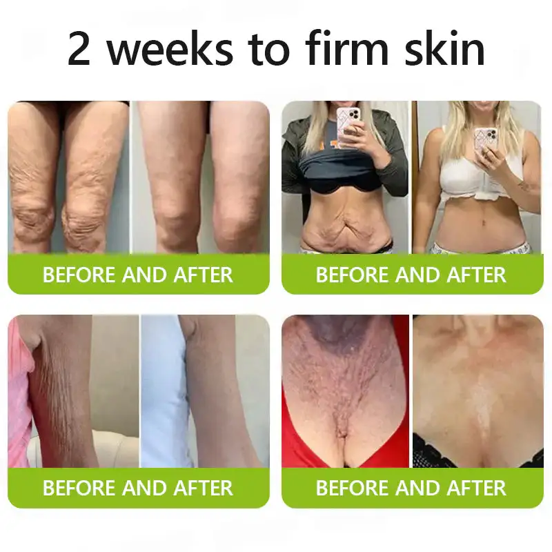 uk ๐ถ๐๐๐๐๐๐๐ ๐บ๐๐๐๐๐ฉโโ๏ธ๐| Regain youthful skin nown ๐ซSTDEIยฎ BOTOX & VITA A RETINOL SHOT Wrinkle Lift Tightening Cream