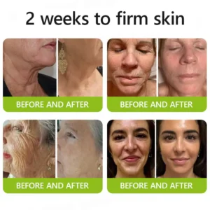 uk ๐ถ๐๐๐๐๐๐๐ ๐บ๐๐๐๐๐ฉโโ๏ธ๐| Regain youthful skin nown ๐ซSTDEIยฎ BOTOX & VITA A RETINOL SHOT Wrinkle Lift Tightening Cream