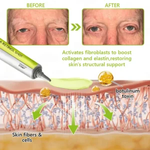 𝑶𝒇𝒇𝒊𝒄𝒊𝒂𝒍 𝑺𝒕𝒐𝒓𝒆👍| BUY 1 GET 1 FREE!!!Regain youthful skin nown 💫STDEI® BOTOX & VITA A RETINOL SHOT Wrinkle Lift Tightening Cream