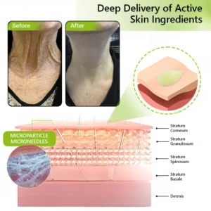 𝑶𝒇𝒇𝒊𝒄𝒊𝒂𝒍 𝑺𝒕𝒐𝒓𝒆👍| BUY 1 GET 1 FREE!!!Regain youthful skin nown 💫STDEI® BOTOX & VITA A RETINOL SHOT Wrinkle Lift Tightening Cream